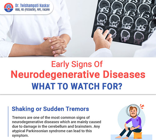 Early Signs Of Neurodegenerative Diseases: What To Watch For?